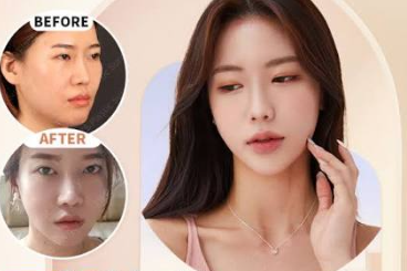 Facial contouring